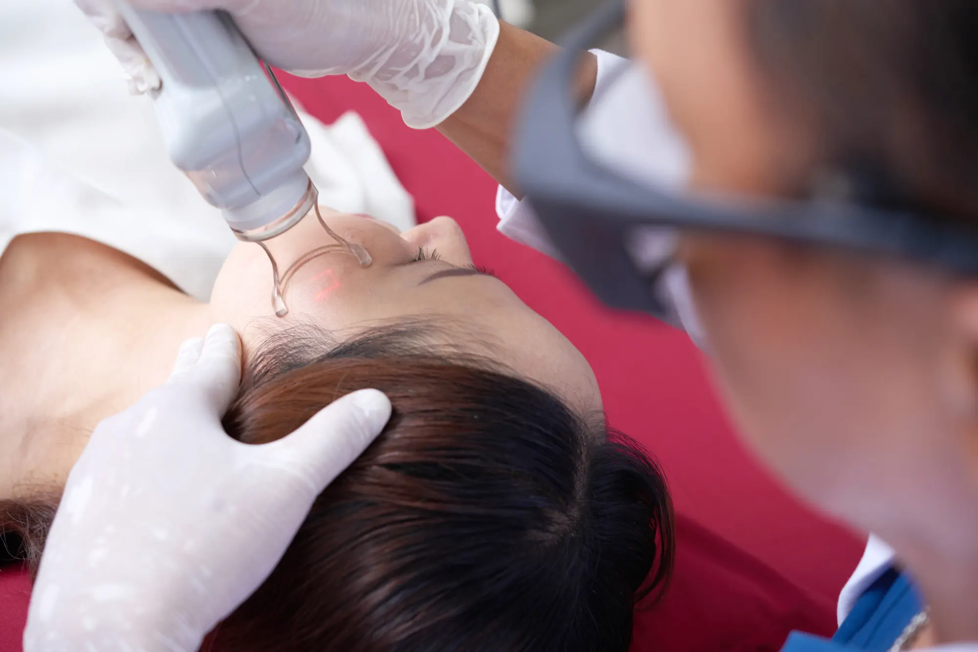 Tratament laser Aerolase pentru pete pigmentare la Reconnect Clinic