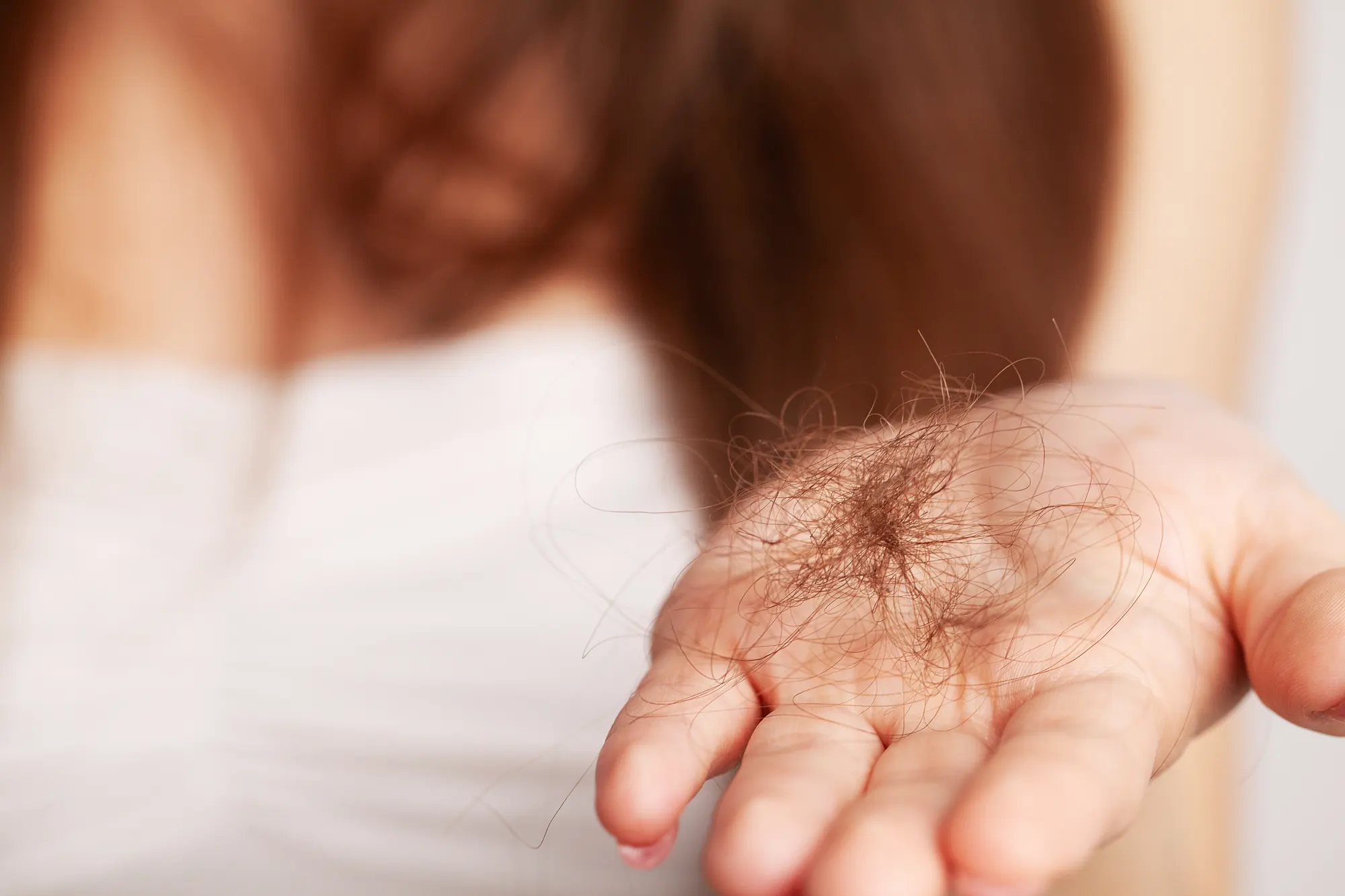 Tratament PRP capilar la Reconnect Clinic pentru căderea părului