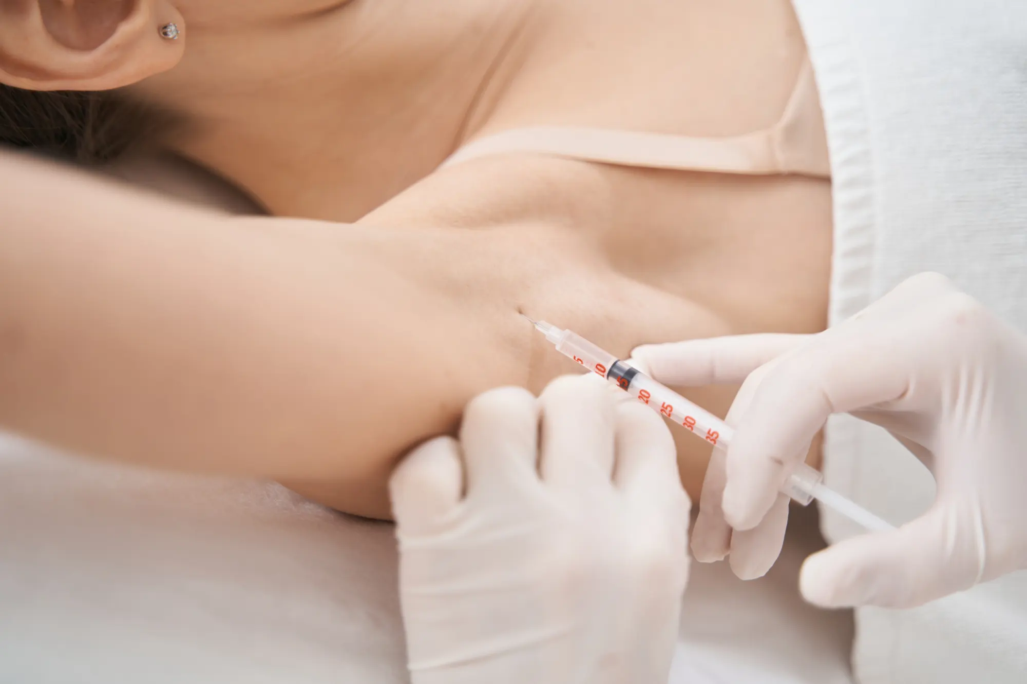 Tratament injectabil pentru transpirație excesivă